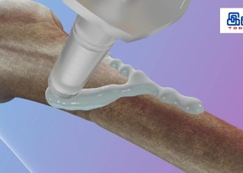 எலும்பு முறிவை 3 நிமிடங்களில் குணமாக்கும் Bone-02