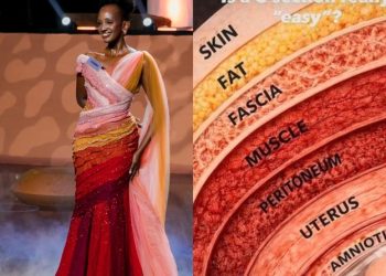 உடற்கூறியல் மற்றும்  Fashion கலந்த அற்புதம்: